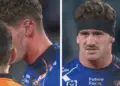 Bulldog’s gruesome injury in upset win over Warriors