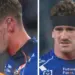 Bulldog’s gruesome injury in upset win over Warriors